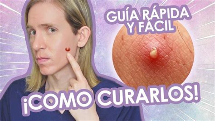 Como para el pus?