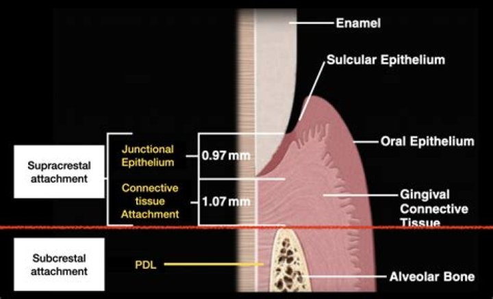 Does a fiberotomy hurt?