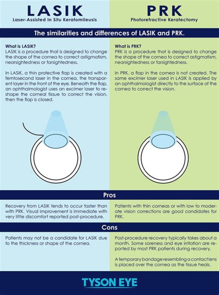 Does corneal thickness increase after LASIK?