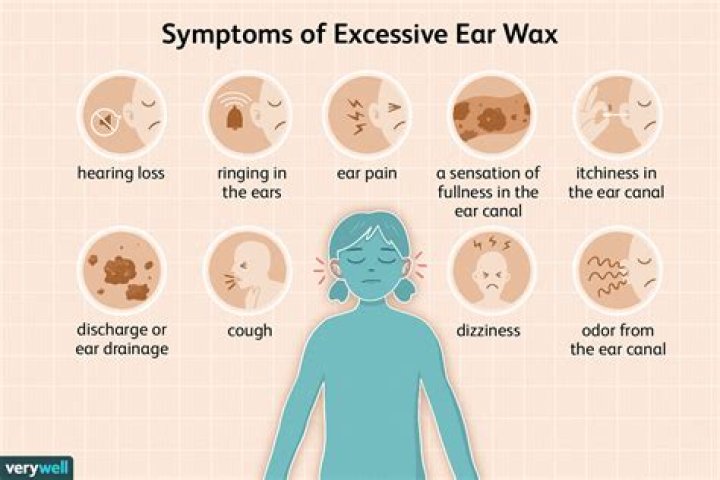 How do you get impacted ear wax out of a toddler?