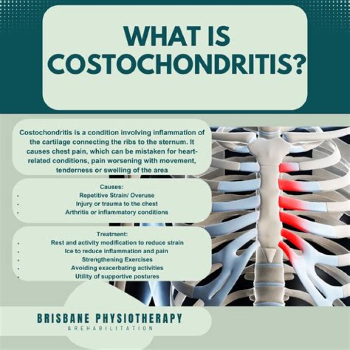 How does a person get costochondritis?
