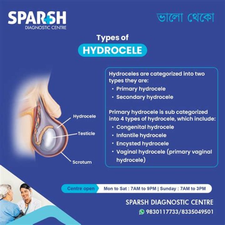How large can a hydrocele get?