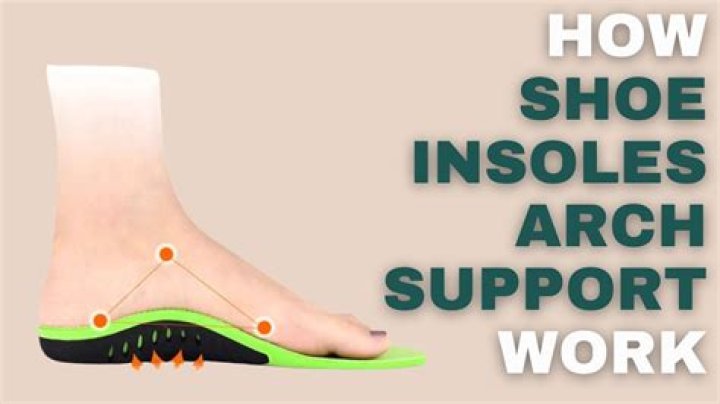 How much does an arch support cost?