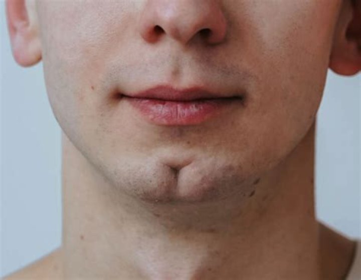 Is cleft chin masculine?