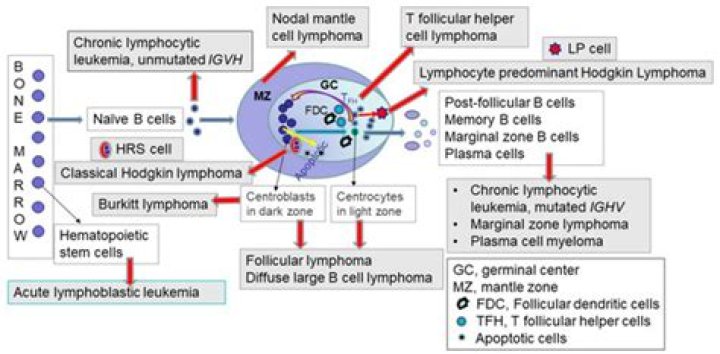 Is lymphoblastic and lymphocytic leukemia the same?