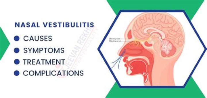 Is nasal Vestibulitis serious?