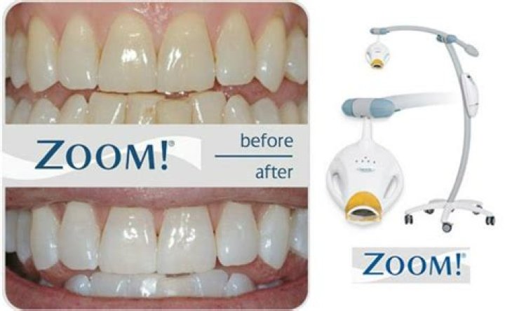 Is Zoom whitening safe for your teeth?