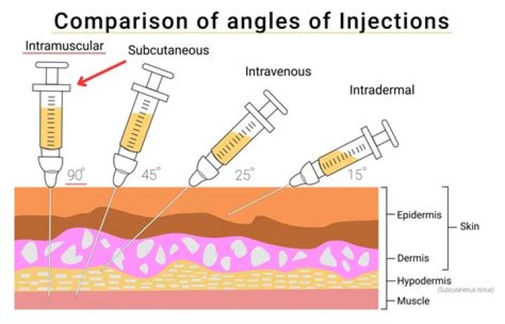 What are the injections and the leakage?
