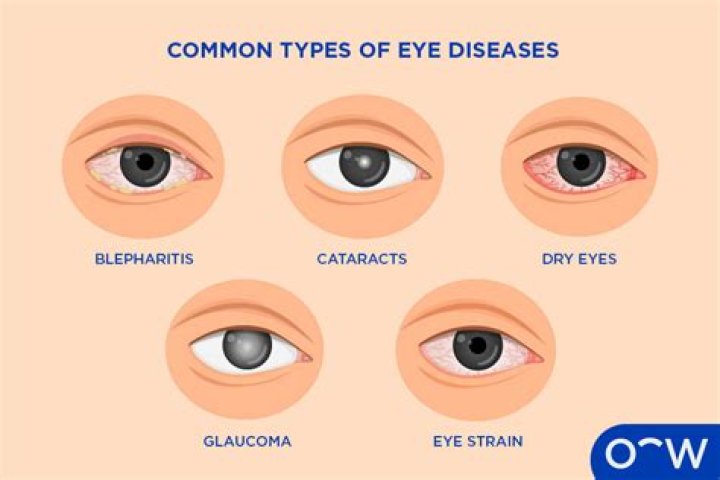 What can cause eyesight to deteriorate quickly?