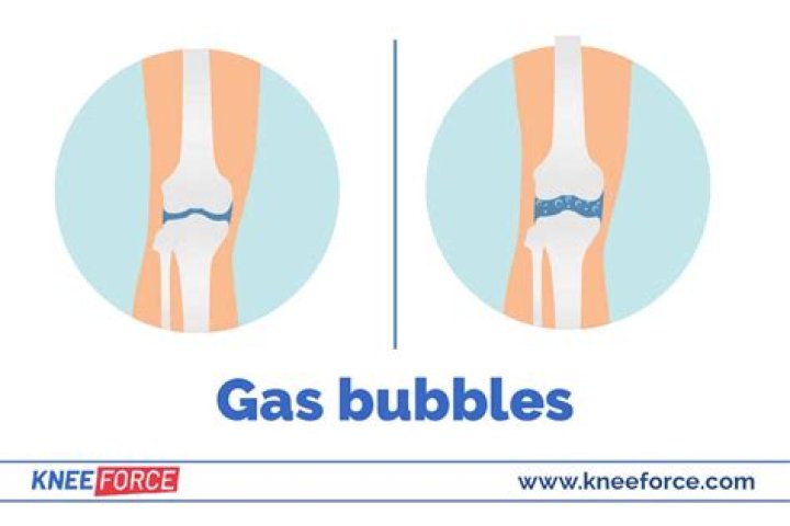 What causes gas bubbles in joints?
