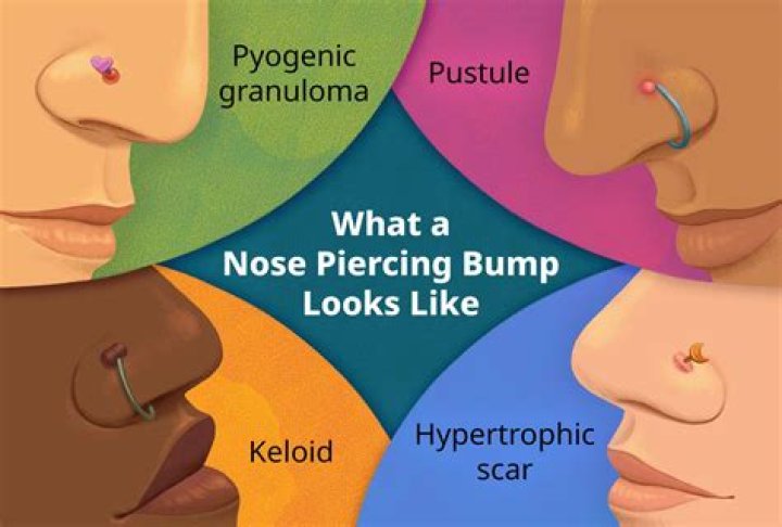 What causes your nose to get bigger?
