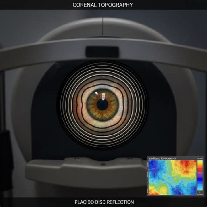 What do Placido disc topographers directly measure?