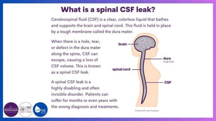 What happens if a spinal tap leaks?