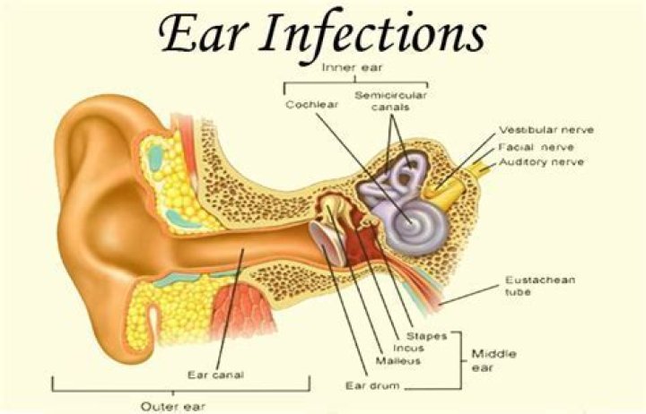 What happens if an ear infection spreads to the bone?