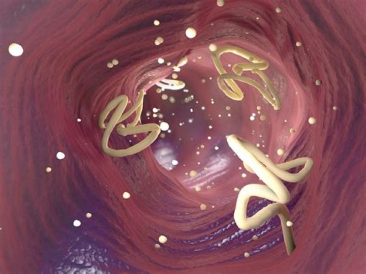 What is a Cestodes infection?