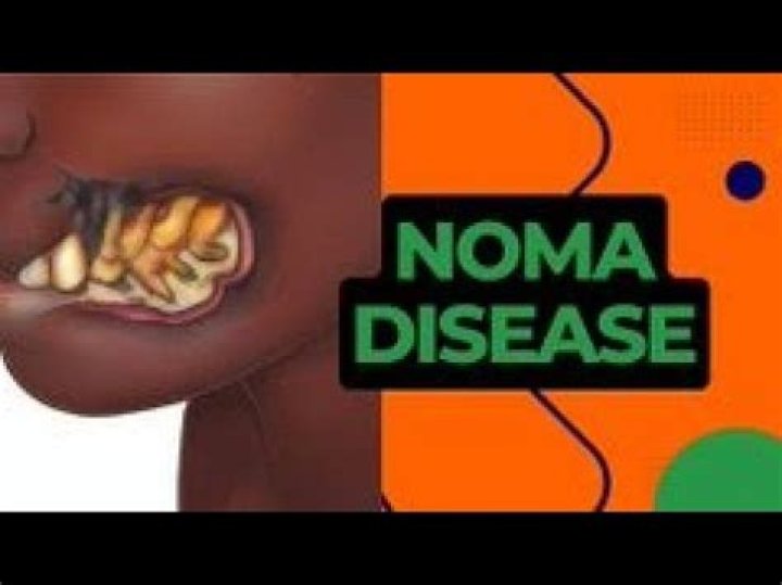 What is Noma and why did it get famous?
