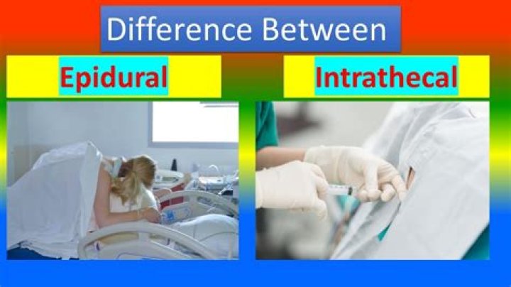 What is the difference between intrathecal and epidural?