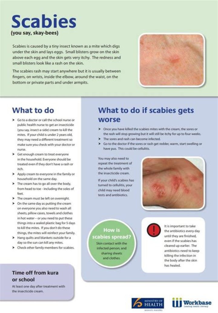 What is the first line treatment for scabies?